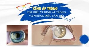 GIOi-thieu-ve-kinh-ap-trong-2